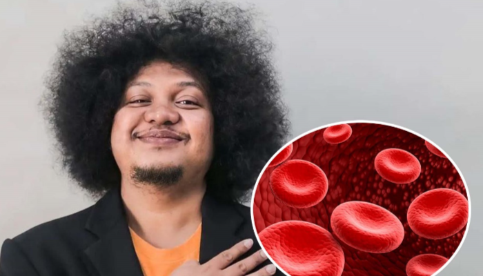 Anemia Aplastik Merupakan Penyakit Yang Di Derita Babe Cabiita