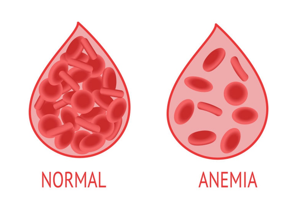 5 Makanan Penambah Darah Solusi Untuk Penderita Anemia