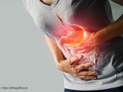 Mengenal Gejala an Penyebab Asam Lambung